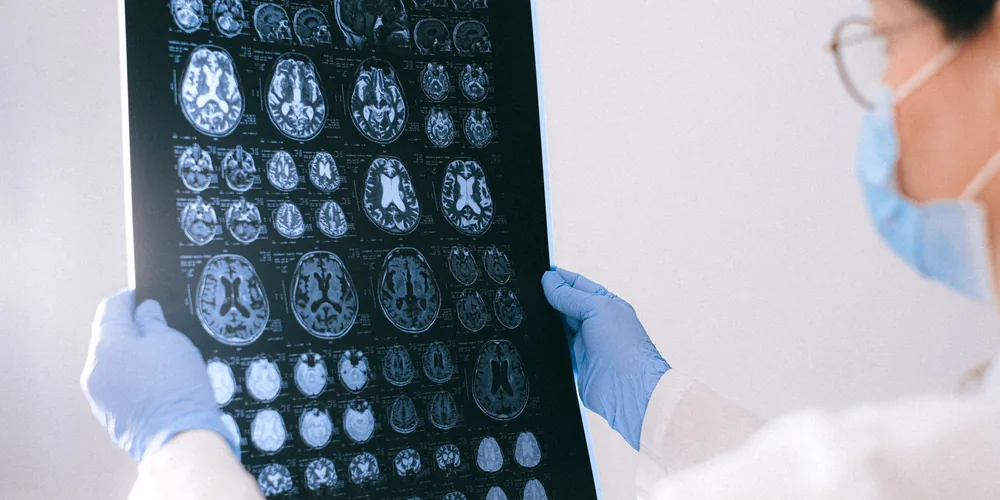 Hipofiz Adenomu Nedir? MR'da Tesadüfen Bulunan Hipofiz Kitlesi